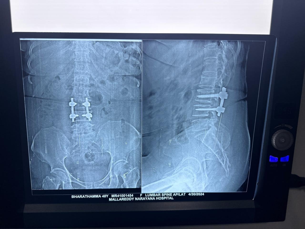 Case Review 3
