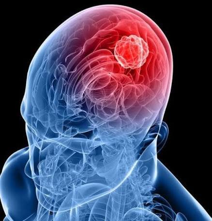 Neuro Oncology Brain Tumor Resection Setup